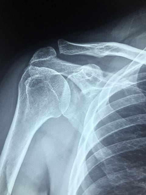 x-ray